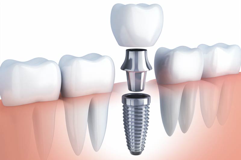 Dany Jose Dental - Leesburg Special Offer