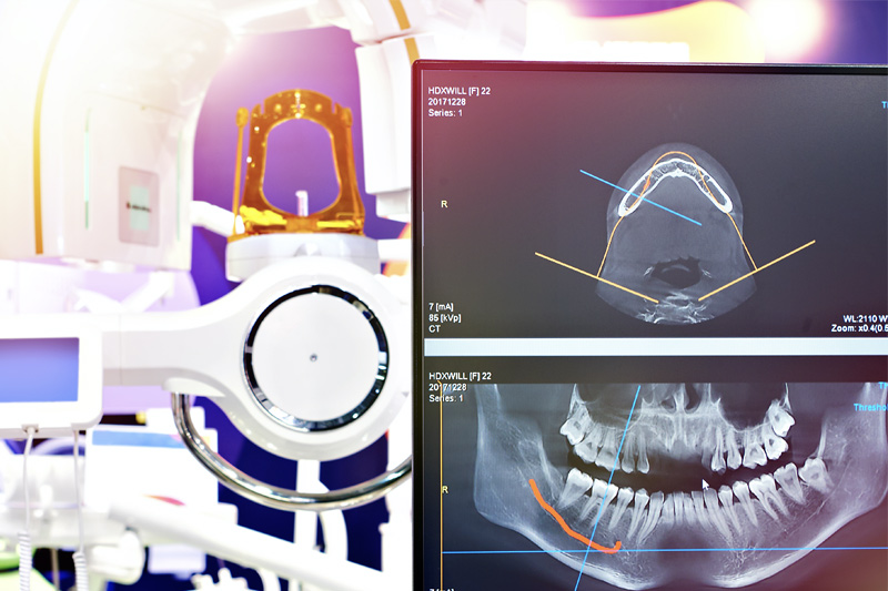 Digital X-Rays in Leesburg